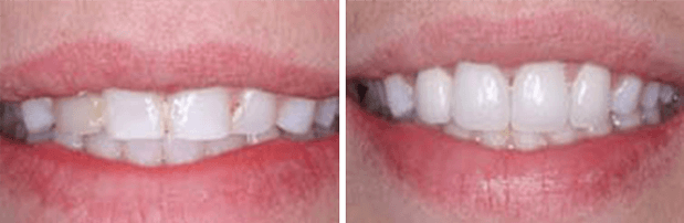 Cosmetic Dentistry 2