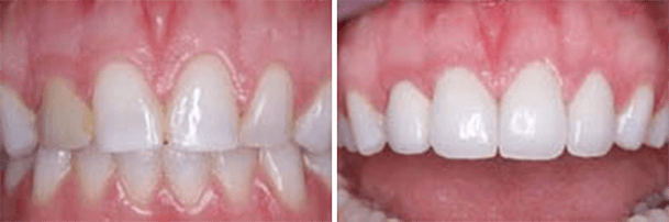 Cosmetic Dentistry 1